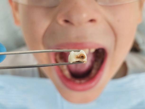 Best Tooth Infection Emergency Dentist  in Dover, NJ